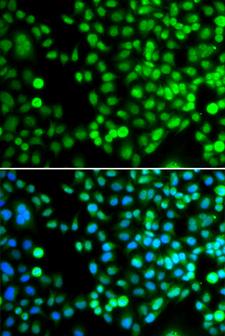 BCAS3 Antibody - Immunofluorescence analysis of MCF7 cells.