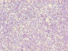 BCAS3 Antibody - Immunohistochemistry of paraffin-embedded human thymus tissue at dilution 1:100