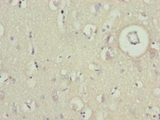 BCAS3 Antibody - Immunohistochemistry of paraffin-embedded human brain tissue at dilution 1:100