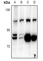 BCAS3 Antibody - Western blot analysis of BCAS3 expression in A549 (A), HEK293T (B), mouse lung (C), rat lung (D) whole cell lysates.