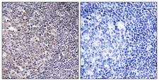 BCAS4 Antibody - Immunohistochemistry analysis of paraffin-embedded human tonsil tissue, using BCAS4 Antibody. The picture on the right is blocked with the synthesized peptide.