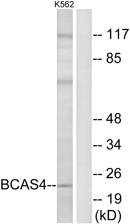 BCAS4 Antibody - Western blot analysis of lysates from K562 cells, using BCAS4 Antibody. The lane on the right is blocked with the synthesized peptide.