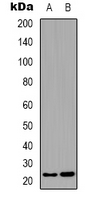 BCAS4 Antibody - Western blot analysis of BCAS4 expression in A431 (A); K562 (B) whole cell lysates.