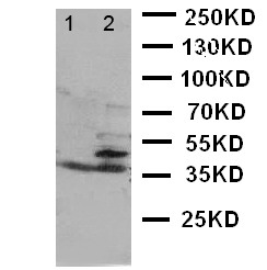 BCAT1 / ECA39 Antibody - WB of BCAT1 / ECA39 antibody. Lane 1: HELA Cell Lysate. Lane 2: JURKAT Cell Lysate.