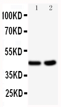 BCAT1 / ECA39 Antibody - Anti-BCAT1 antibody, Western blotting All lanes: Anti BCAT1 at 0.5ug/ml Lane 1: HELA Whole Cell Lysate at 40ug Lane 2: JURKAT Whole Cell Lysate at 40ug Predicted bind size: 45KD Observed bind size: 45KD