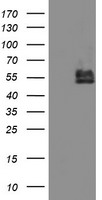 BCAT1 / ECA39 Antibody - HEK293T cells were transfected with the pCMV6-ENTRY control (Left lane) or pCMV6-ENTRY BCAT1 (Right lane) cDNA for 48 hrs and lysed. Equivalent amounts of cell lysates (5 ug per lane) were separated by SDS-PAGE and immunoblotted with anti-BCAT1.