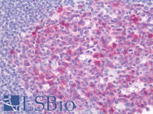 BCAT1 / ECA39 Antibody - Anti-BCAT1 / ECA39 antibody IHC staining of human tonsil. Immunohistochemistry of formalin-fixed, paraffin-embedded tissue after heat-induced antigen retrieval. Antibody concentration 10 ug/ml.