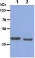 BCAT1 / ECA39 Antibody - The Cell lysates (40ug) were resolved by SDS-PAGE, transferred to PVDF membrane and probed with anti-human BCAT1 antibody (1:1000). Proteins were visualized using a goat anti-mouse secondary antibody conjugated to HRP and an ECL detection system. Lane 1. : Jurkat cell lysate Lane 2. : HeLa cell lysate