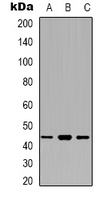 BCAT1 / ECA39 Antibody - Western blot analysis of ECA39 expression in Jurkat (A); K562 (B); Jurkat (C) whole cell lysates.
