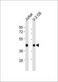 BCAT1 / ECA39 Antibody - All lanes : Anti-ECA39 Antibody at 1:1000 dilution Lane 1: Jurkat whole cell lysates Lane 2: U-2 OS whole cell lysates Lysates/proteins at 20 ug per lane. Secondary Goat Anti-Rabbit IgG, (H+L),Peroxidase conjugated at 1/10000 dilution Predicted band size : 43 kDa Blocking/Dilution buffer: 5% NFDM/TBST.
