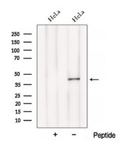 BCAT1 / ECA39 Antibody - Western blot analysis of extracts of HeLa cells using BCAT1/ECA39 antibody. The lane on the left was treated with blocking peptide.