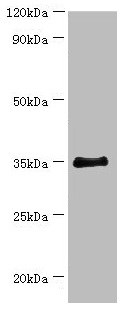 BCAT2 Antibody - Western blot All lanes: BCAT2 antibody at 14µg/ml + 293T whole cell lysate Secondary Goat polyclonal to rabbit IgG at 1/10000 dilution Predicted band size: 45, 34 kDa Observed band size: 34 kDa