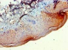 BCAT2 Antibody - Immunohistochemistry of paraffin-embedded human skin tissue using antibody at 1:100 dilution.  This image was taken for the unconjugated form of this product. Other forms have not been tested.