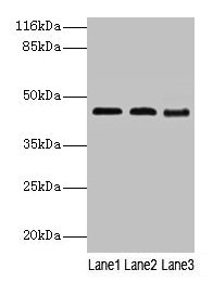 BCAT2 Antibody - Western blot All lanes: Branched-chain-amino-acid aminotransferase, mitochondrial antibody at 2µg/ml Lane 1: NIH/3T3 whole cell lysate Lane 2: Mouse kidney tissue Lane 3: Mouse spleen tissue Secondary Goat polyclonal to rabbit IgG at 1/10000 dilution Predicted band size: 45, 34 kDa Observed band size: 45 kDa