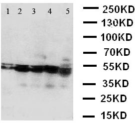 BCAT2 Antibody - WB of BCAT2 antibody. Lane 1: A431 Cell Lysate. Lane 2: SW620 Cell Lysate. Lane 3: SMMC Cell Lysate. Lane 4: JURKAT Cell Lysate. Lane 5: CEM Cell Lysate.