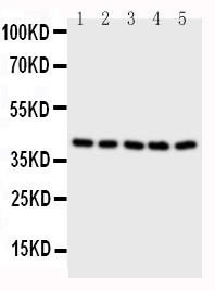 BCAT2 Antibody - Anti-BCAT2 antibody, Western blotting All lanes: Anti BCAT2 at 0.5ug/ml Lane 1: A431 Whole Cell Lysate at 40ug Lane 2: SW620 Whole Cell Lysate at 40ug Lane 3: SMMC Whole Cell Lysate at 40ug Lane 4: JURKAT Whole Cell Lysate at 40ug Lane 5: CEM Whole Cell Lysate at 40ug Predicted bind size: 41KD Observed bind size: 41KD