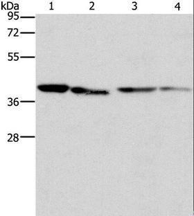 BCAT2 Antibody - Western blot analysis of Human placenta tissue and NIH/3T3 cell, Raji and hepG2 cell, using BCAT2 Polyclonal Antibody at dilution of 1:312.5.