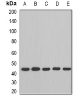 BCAT2 Antibody - Western blot analysis of BCAT2 expression in Raji (A); MCF7 (B); mouse heart (C); mouse testis (D); rat kidney (E) whole cell lysates.
