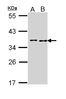 BCCIP Antibody - Sample (30 ug of whole cell lysate). A: A431 , B: Hela. 10% SDS PAGE. BCCIP antibody diluted at 1:1000.