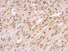 BCCIP Antibody - BCCIP antibody detects BCCIP protein at nucleus on U373 xenograft by immunohistochemical analysis. Sample: Paraffin-embedded U373 xenograft. BCCIP antibody dilution:1:500.