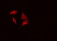 BCCIP Antibody - Staining HeLa cells by IF/ICC. The samples were fixed with PFA and permeabilized in 0.1% Triton X-100, then blocked in 10% serum for 45 min at 25°C. The primary antibody was diluted at 1:200 and incubated with the sample for 1 hour at 37°C. An Alexa Fluor 594 conjugated goat anti-rabbit IgG (H+L) antibody, diluted at 1/600, was used as secondary antibody.