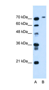 BCHE / Cholinesterase Antibody - BCHE antibody ARP44208_T100-NP_000046-BCHE(butyrylcholinesterase) Antibody Western blot of HepG2 cell lysate.  This image was taken for the unconjugated form of this product. Other forms have not been tested.