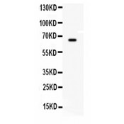 BCHE / Cholinesterase Antibody - BCHE antibody Western blot. All lanes: Anti BCHE at 0.5 ug/ml. WB: HEPA Whole Cell Lysate at 40 ug. Predicted band size: 66 kD. Observed band size: 66 kD.
