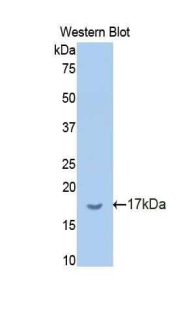 BCHE / Cholinesterase Antibody - Western blot of recombinant BCHE / Cholinesterase.  This image was taken for the unconjugated form of this product. Other forms have not been tested.