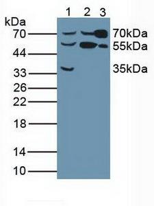 BCHE / Cholinesterase Antibody - Western Blot; Sample: Lane1: Human Liver Tissue ; Lane2: Human Hela Cells; Lane3: Rat Serum.