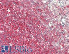 BCHE / Cholinesterase Antibody - Human Spleen: Formalin-Fixed, Paraffin-Embedded (FFPE).  This image was taken for the unconjugated form of this product. Other forms have not been tested.