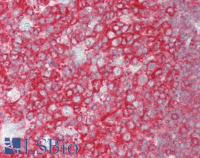 BCHE / Cholinesterase Antibody - Human Tonsil: Formalin-Fixed, Paraffin-Embedded (FFPE).  This image was taken for the unconjugated form of this product. Other forms have not been tested.