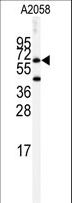 BCHE / Cholinesterase Antibody - Western blot of anti-BCHE Antibody in A2058 cell line lysates (35 ug/lane). BCHE (arrow) was detected using the purified antibody.