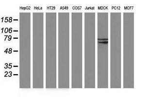BCHE / Cholinesterase Antibody - Western blot of extracts (35 ug) from 9 different cell lines by using anti-BCHE monoclonal antibody (HepG2: human; HeLa: human; SVT2: mouse; A549: human; COS7: monkey; Jurkat: human; MDCK: canine; PC12: rat; MCF7: human).