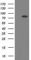 BCHE / Cholinesterase Antibody - HEK293T cells were transfected with the pCMV6-ENTRY control (Left lane) or pCMV6-ENTRY BCHE (Right lane) cDNA for 48 hrs and lysed. Equivalent amounts of cell lysates (5 ug per lane) were separated by SDS-PAGE and immunoblotted with anti-BCHE.