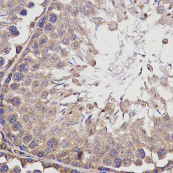BCHE / Cholinesterase Antibody - Immunohistochemistry of paraffin-embedded rat testis using BCHE antibody at dilution of 1:200 (x400 lens).