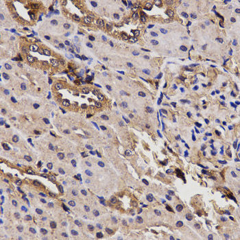 BCHE / Cholinesterase Antibody - Immunohistochemistry of paraffin-embedded rat kidney using BCHE antibody at dilution of 1:200 (x400 lens).