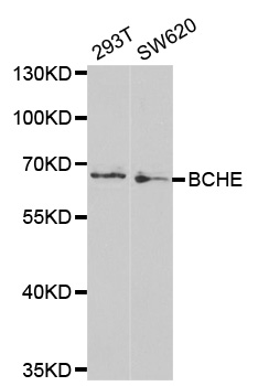 BCHE / Cholinesterase Antibody - Western blot analysis of extracts of various cell lines, using BCHE antibody at 1:1000 dilution. The secondary antibody used was an HRP Goat Anti-Rabbit IgG (H+L) at 1:10000 dilution. Lysates were loaded 25ug per lane and 3% nonfat dry milk in TBST was used for blocking. An ECL Kit was used for detection and the exposure time was 30s.