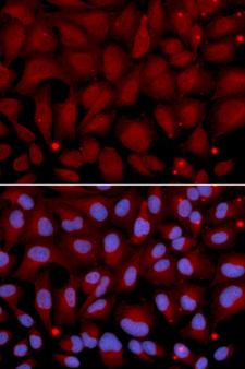 BCHE / Cholinesterase Antibody - Immunofluorescence analysis of U2OS cells using BCHE antibody. Blue: DAPI for nuclear staining.