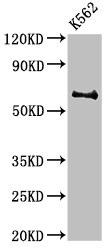 BCHE / Cholinesterase Antibody - Positive Western Blot detected in K562 whole cell lysate. All lanes: BCHE antibody at 3 µg/ml Secondary Goat polyclonal to rabbit IgG at 1/50000 dilution. Predicted band size: 69 KDa. Observed band size: 69 KDa