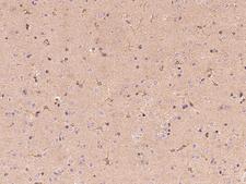 BCHE / Cholinesterase Antibody - Immunochemical staining of mouse BCHE in mouse brain with rabbit polyclonal antibody at 1:1000 dilution, formalin-fixed paraffin embedded sections.