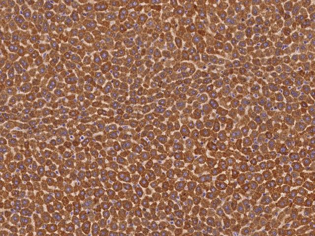 BCHE / Cholinesterase Antibody - Immunochemical staining of mouse BCHE in mouse liver with rabbit polyclonal antibody at 1:1000 dilution, formalin-fixed paraffin embedded sections.