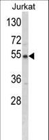 BCKDHA / BCKDE1A Antibody - Western blot of BCKDHA Antibody in Jurkat cell line lysates (35 ug/lane). BCKDHA (arrow) was detected using the purified antibody.
