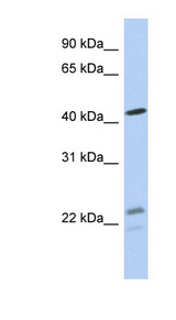 BCKDHA / BCKDE1A Antibody - BCKDHA antibody Western blot of MCF7 cell lysate. This image was taken for the unconjugated form of this product. Other forms have not been tested.