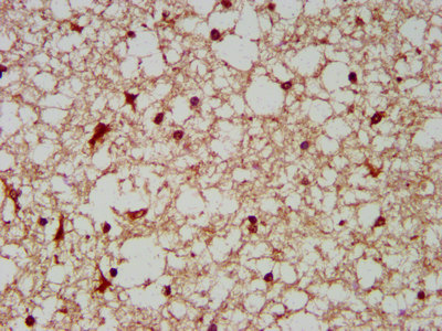 BCKDHA / BCKDE1A Antibody - Immunohistochemistry image at a dilution of 1:200 and staining in paraffin-embedded human brain tissue performed on a Leica BondTM system. After dewaxing and hydration, antigen retrieval was mediated by high pressure in a citrate buffer (pH 6.0) . Section was blocked with 10% normal goat serum 30min at RT. Then primary antibody (1% BSA) was incubated at 4 °C overnight. The primary is detected by a biotinylated secondary antibody and visualized using an HRP conjugated SP system.