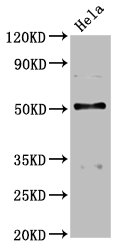 BCKDHA / BCKDE1A Antibody - Positive Western Blot detected in Hela whole cell lysate. All lanes: BCKDHA antibody at 4.58 µg/ml Secondary Goat polyclonal to rabbit IgG at 1/50000 dilution. Predicted band size: 51 KDa. Observed band size: 51 KDa