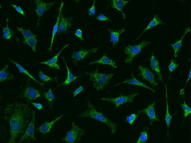 BCKDHA / BCKDE1A Antibody - Immunofluorescence staining of BCKDHA in Hela cells. Cells were fixed with 4% PFA, permeabilzed with 0.1% Triton X-100 in PBS, blocked with 10% serum, and incubated with rabbit anti-Human BCKDHA polyclonal antibody (dilution ratio 1:500) at 4°C overnight. Then cells were stained with the Alexa Fluor 488-conjugated Goat Anti-rabbit IgG secondary antibody (green) and counterstained with DAPI (blue). Positive staining was localized to Cytoplasm.