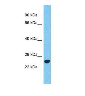 BCKDHB Antibody - Western blot of Human Thyroid tumor. BCKDHB antibody dilution 1.0 ug/ml.  This image was taken for the unconjugated form of this product. Other forms have not been tested.
