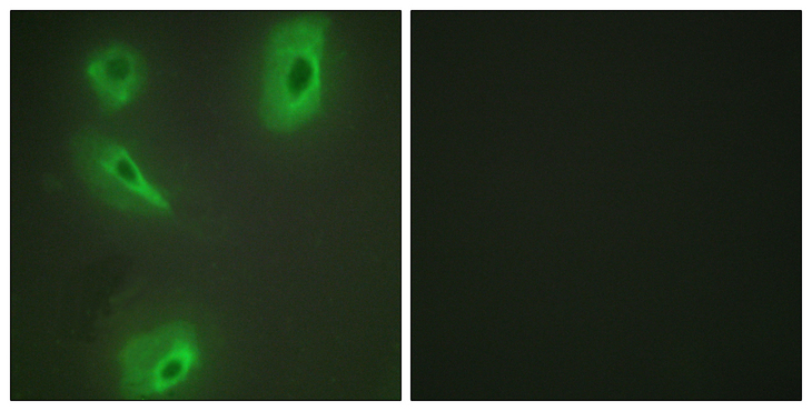 BCKDK Antibody - Immunofluorescence analysis of HeLa cells, using BCKD Antibody . The picture on the right is blocked with the synthesized peptide.