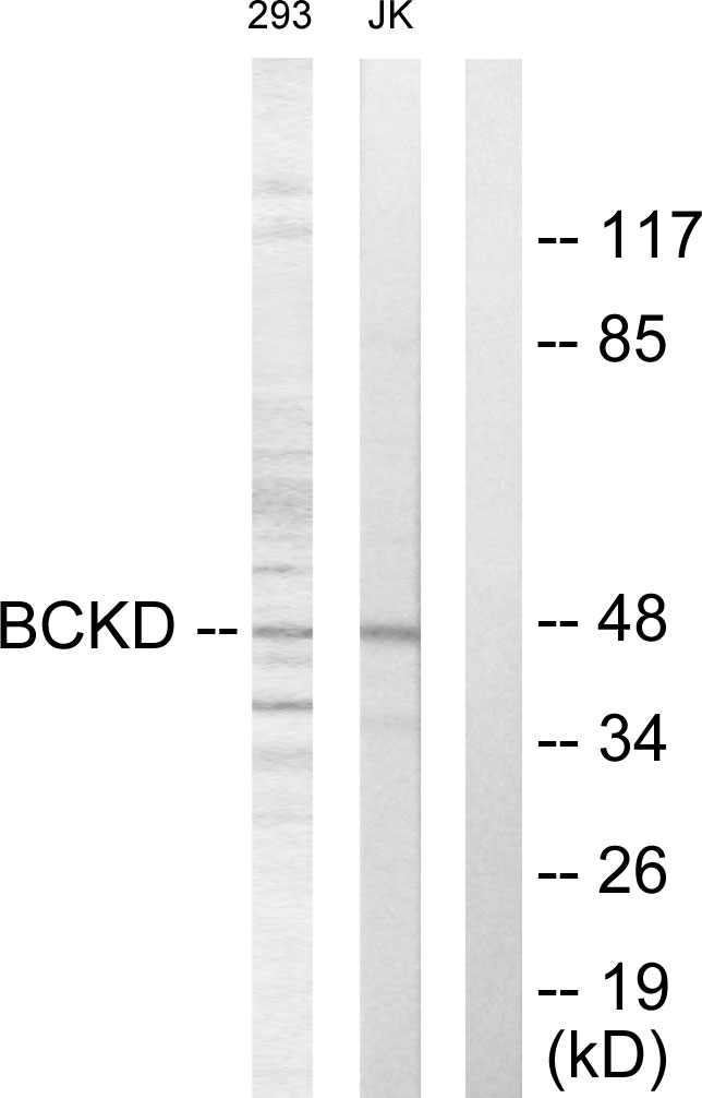 BCKDK Antibody - Western blot analysis of lysates from Jurkat and 293 cells, using BCKD Antibody . The lane on the right is blocked with the synthesized peptide.