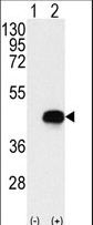 BCKDK Antibody - Western blot of BCKDK (arrow) using rabbit polyclonal BCKDK Antibody. 293 cell lysates (2 ug/lane) either nontransfected (Lane 1) or transiently transfected with the BCKDK gene (Lane 2) (Origene Technologies).
